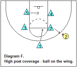 1-2-2 zone defense - Defending the high post
