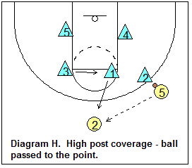 1-2-2 zone defense - Defending the high post