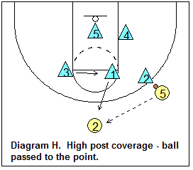 1-2-2 zone defense - Defending the high post