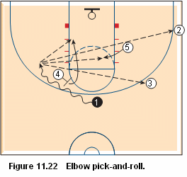 Basketball pick and roll offense - elbow pick and roll