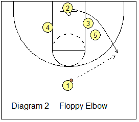 floppy elbow action