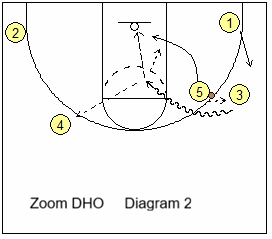 Zoom action - DHO